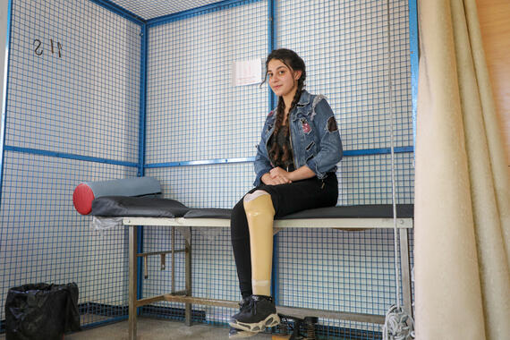 A smiling young girl with a prothesis sits on an examination bed inside a room.